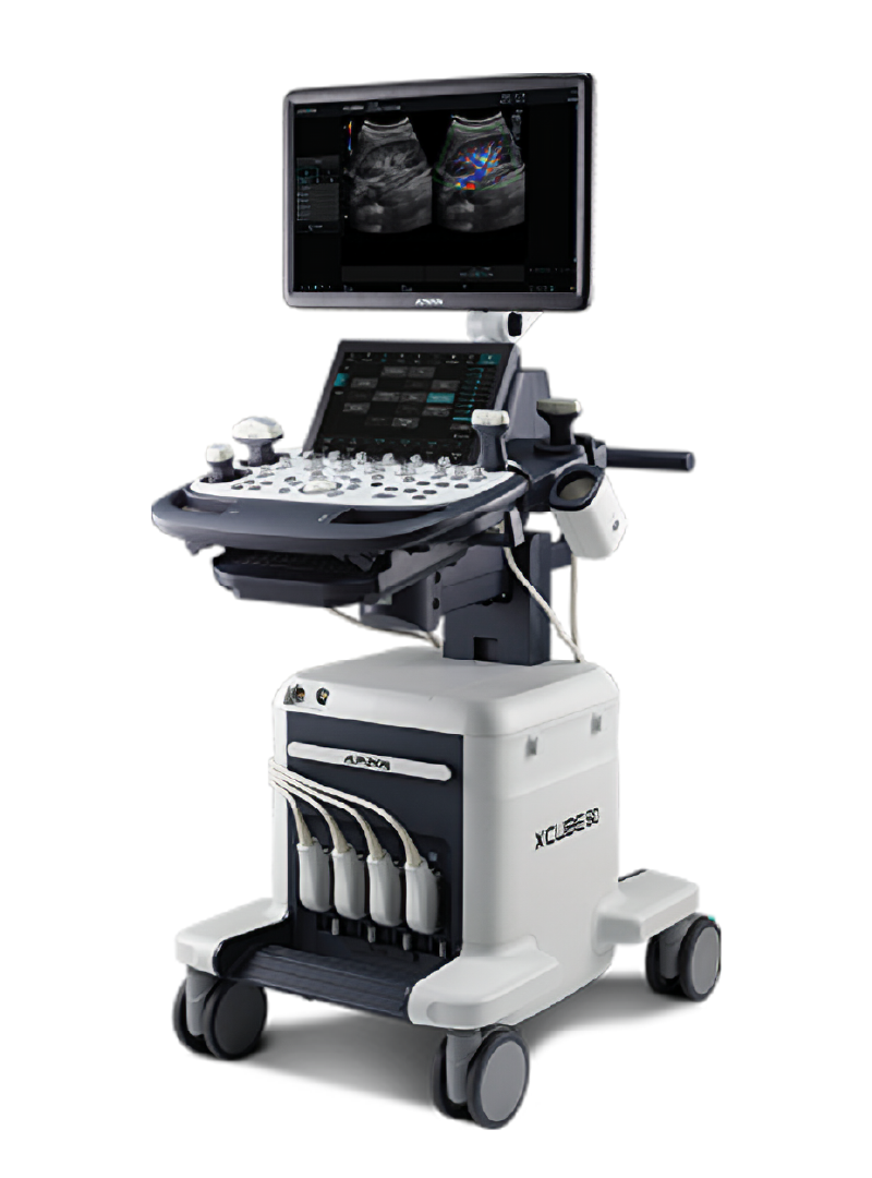 근골격계 초음파 진단기